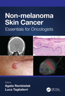 Non-melanoma Skin Cancer : Essentials for Oncologists