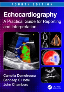 Echocardiography : A Practical Guide for Reporting and Interpretation