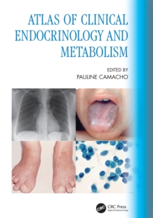 Atlas of Clinical Endocrinology and Metabolism