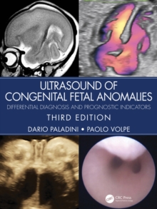 Ultrasound of Congenital Fetal Anomalies : Differential Diagnosis and Prognostic Indicators