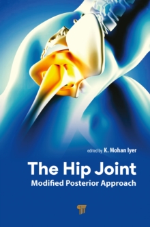 The Hip Joint : Modified Posterior Approach