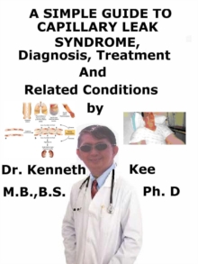 Simple Guide to Capillary Leak Syndrome, Diagnosis, Treatment and Related Conditions