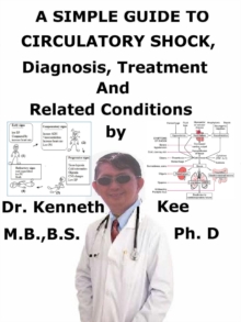 Simple Guide to Circulatory Shock, Diagnosis, Treatment and Related Conditions