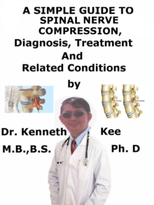 Simple Guide to Spinal Nerve Compression, Diagnosis, Treatment and Related Conditions