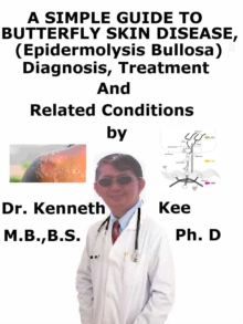 Simple Guide to Butterfly Skin Disease (Epidermolysis Bullosa), Diagnosis, Treatment and Related Conditions