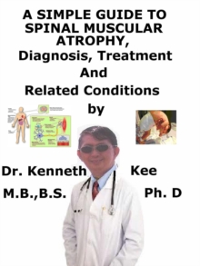 Simple Guide to Spinal Muscular Atrophy, Diagnosis, Treatment and Related Conditions