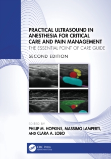 Practical Ultrasound in Anesthesia for Critical Care and Pain Management : The Essential Point of Care Guide