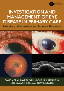 Investigation & Management of Eye Disease in Primary Care : Infection, Inflammation and Immune Response
