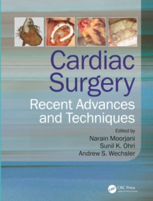 Cardiac Surgery : Recent Advances and Techniques