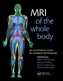 MRI of the Whole Body : An Illustrated Guide for Common Pathologies