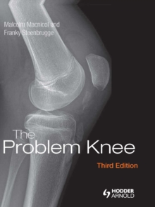 The Problem Knee