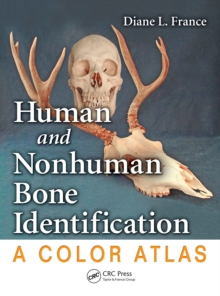 Human and Nonhuman Bone Identification : A Color Atlas