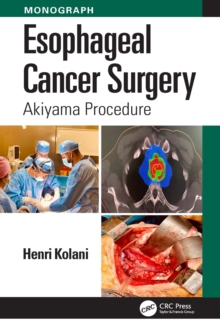 Esophageal Cancer Surgery : Akiyama Procedure