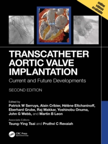 Transcatheter Aortic Valve Implantation : Current and Future Developments