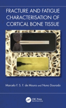 Fracture and Fatigue Characterisation of Cortical Bone Tissue