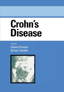 Crohn's Disease