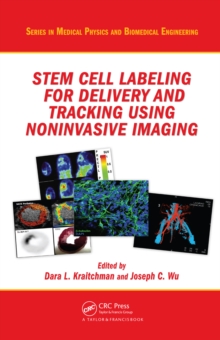 Stem Cell Labeling for Delivery and Tracking Using Noninvasive Imaging