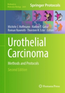 Urothelial Carcinoma : Methods and Protocols