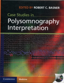 Case Studies in Polysomnography Interpretation, Hardback Book Case Studies in Polysomnography Interpretation, Hardback Book