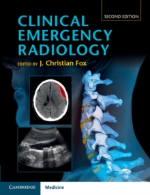 Clinical Emergency Radiology, Hardback Book Clinical Emergency Radiology, Hardback Book