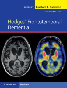 Hodges' Frontotemporal Dementia, Hardback Book Hodges' Frontotemporal Dementia, Hardback Book