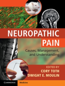 Neuropathic Pain : Causes, Management and Understanding