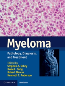 Myeloma : Pathology, Diagnosis, and Treatment