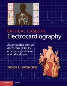 Critical Cases in Electrocardiography : An Annotated Atlas of Don't-Miss ECGs for Emergency Medicine and Critical Care
