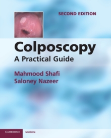 Colposcopy : A Practical Guide