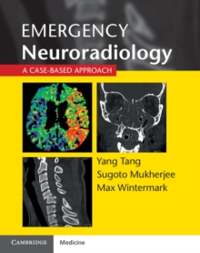 Emergency Neuroradiology : A Case-Based Approach, Paperback / softback Book Emergency Neuroradiology : A Case-Based Approach, Paperback / softback Book