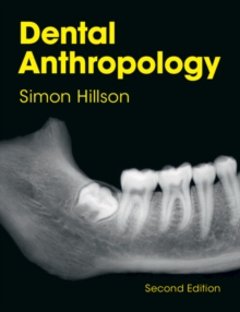 Dental Anthropology