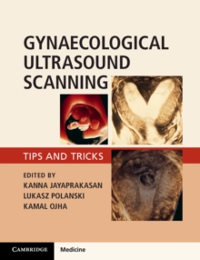 Gynaecological Ultrasound Scanning : Tips and Tricks