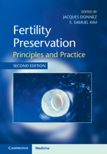 Fertility Preservation : Principles and Practice