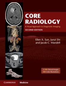 Core Radiology : A Visual Approach to Diagnostic Imaging