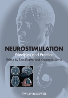 Neurostimulation : Principles and Practice