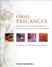 Oral Precancer : Diagnosis and Management of Potentially Malignant Disorders