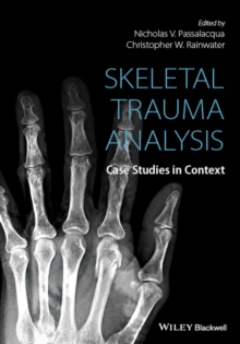 Skeletal Trauma Analysis : Case Studies in Context, Hardback Book Skeletal Trauma Analysis : Case Studies in Context, Hardback Book