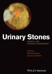Urinary Stones : Medical and Surgical Management, Hardback Book Urinary Stones : Medical and Surgical Management, Hardback Book