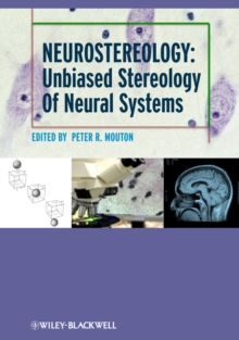 Neurostereology : Unbiased Stereology of Neural Systems