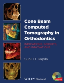 Cone Beam Computed Tomography in Orthodontics : Indications, Insights, and Innovations, Hardback Book Cone Beam Computed Tomography in Orthodontics : Indications, Insights, and Innovations, Hardback Book