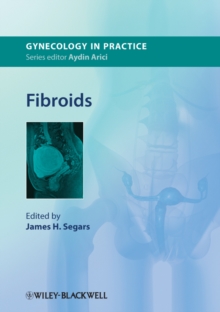 Fibroids