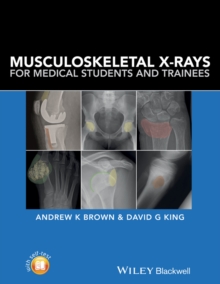 Musculoskeletal X-Rays For Medical Students And Trainees