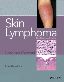 Skin Lymphoma : The Illustrated Guide