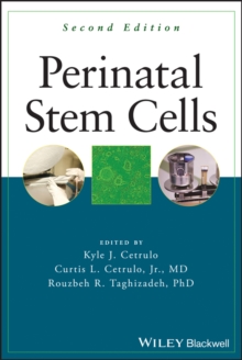 Perinatal Stem Cells