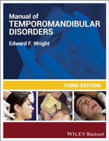 Manual of Temporomandibular Disorders, Paperback / softback Book Manual of Temporomandibular Disorders, Paperback / softback Book