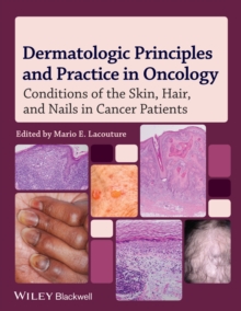 Dermatologic Principles and Practice in Oncology : Conditions of the Skin, Hair, and Nails in Cancer Patients