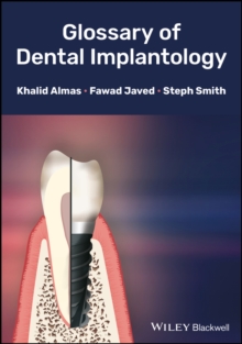 Glossary of Dental Implantology, Hardback Book Glossary of Dental Implantology, Hardback Book