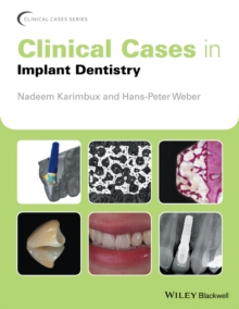 Clinical Cases in Implant Dentistry, Paperback / softback Book Clinical Cases in Implant Dentistry, Paperback / softback Book