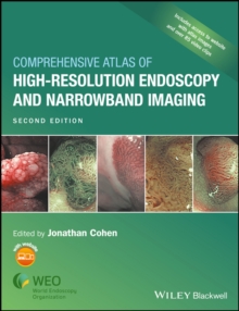Comprehensive Atlas of High-Resolution Endoscopy and Narrowband Imaging, Hardback Book Comprehensive Atlas of High-Resolution Endoscopy and Narrowband Imaging, Hardback Book
