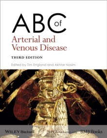 John Wiley & Sons Inc Abc Of Arterial And Venous Disease